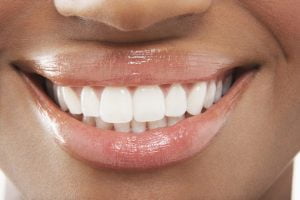 Dental Whitening Products