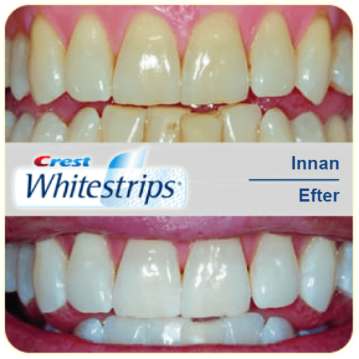 crest whitestrips före efter