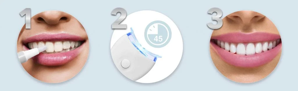 LED Teeth Whitening Kit - Non Peroxide Whitening in 3 steps