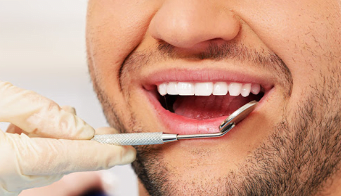 Natural teeth-whitening